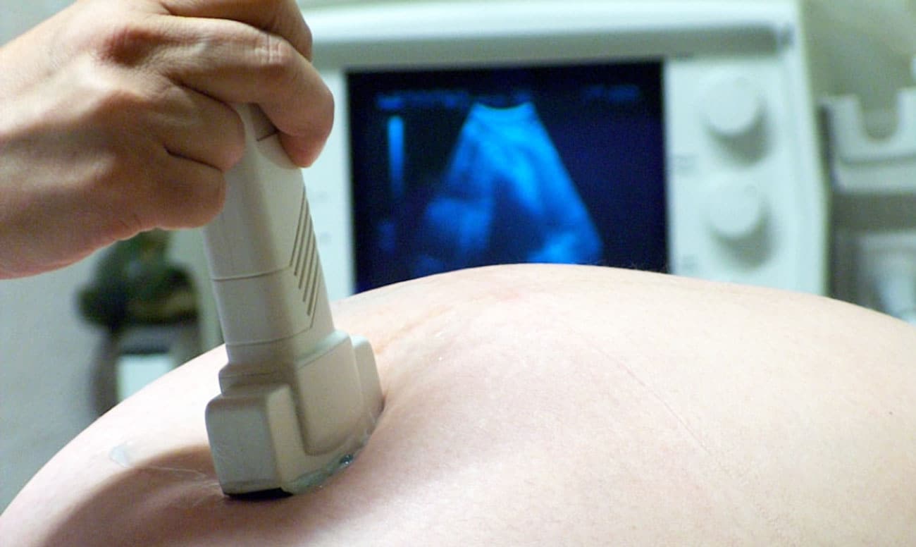 Estoy embarazada ¿Qué pruebas de diagnóstico fetal puedo realizar?. Clínica Ginecológica Elcano Bilbao