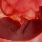 Técnicas de Diagnóstico más recomendadas para el control del embarazo. Clínica Ginecológica Elcano Bilbao